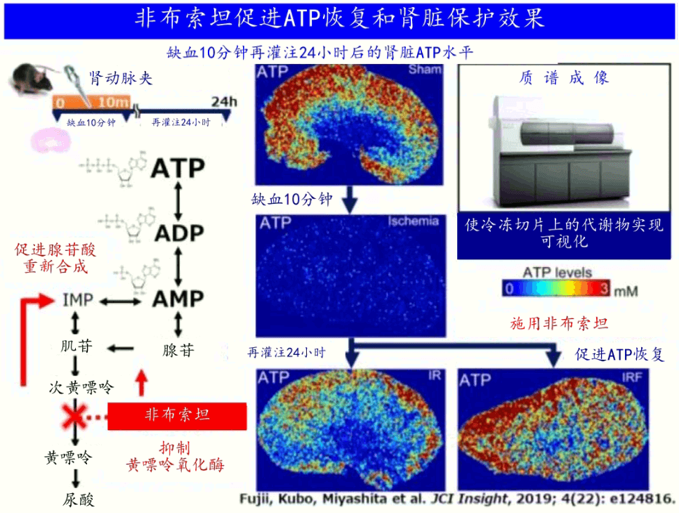 日本查清降尿酸藥物控制代謝來抑制腎耗竭的機制