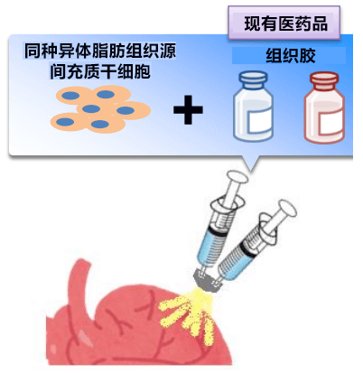 細胞噴霧法冶癒心衰，阪大醫院開始臨牀試驗