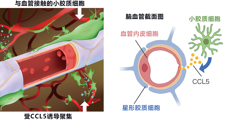 精神分裂症及神經退行性疾病冶癒的好消息！日本查明腦内小膠質細胞可控制血腦障壁