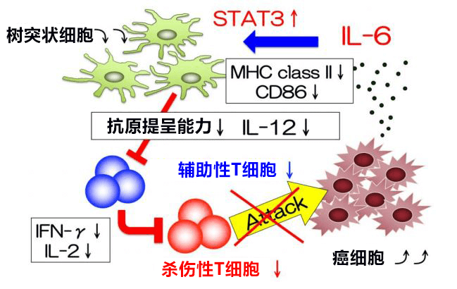 日本查清促進大腸癌肝轉移的新控制機制，阻斷IL-6訊號有望抑制轉移