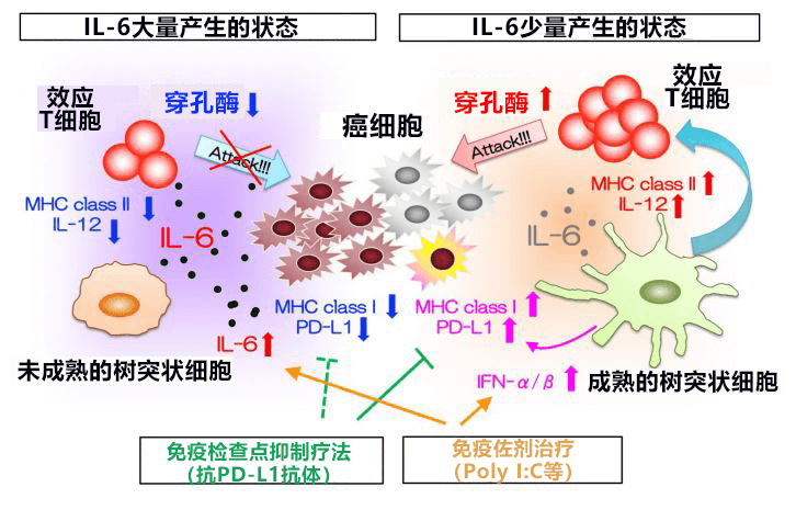 日本查清促進大腸癌肝轉移的新控制機制，阻斷IL-6訊號有望抑制轉移