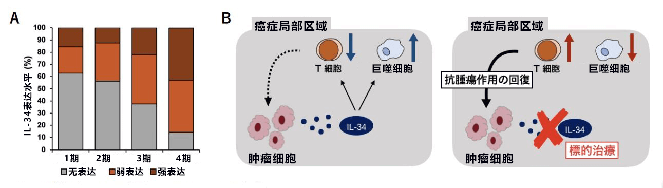 日本首次查明IL-34加大卵巢癌惡性度，有望開發靶向IL-34的卵巢癌新療法