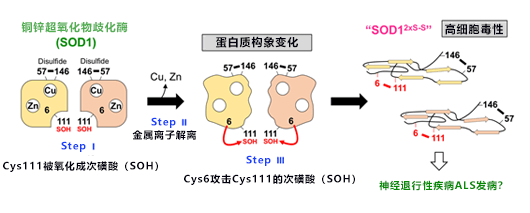 日本發現SOD1高毒性異常構造形成的新機制，有望查清漸凍症發病機理