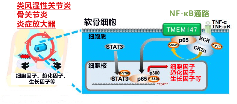 全球首次！日本發現軟骨細胞會誘發關節炎