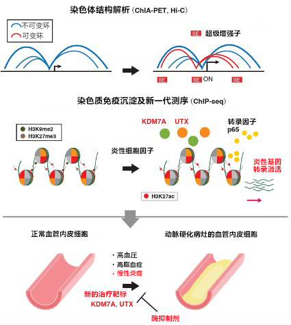 日美合作查清動脈硬化的發炎機制