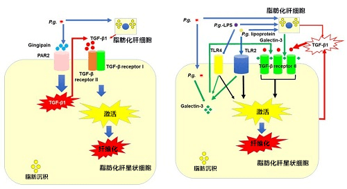 廣島大學：牙周炎可加劇非酒精性脂肪性肝病