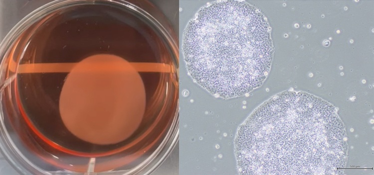 title